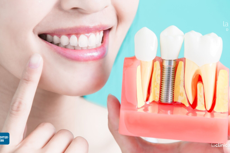 ventajas y desventajas de los implantes dentales
